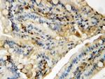 JNK1/JNK2 Antibody in Immunohistochemistry (Paraffin) (IHC (P))