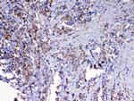 MAVS Antibody in Immunohistochemistry (Paraffin) (IHC (P))