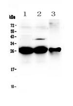 MBL2 Antibody in Western Blot (WB)