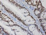 MCM2 Antibody in Immunohistochemistry (Paraffin) (IHC (P))