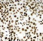 MCM2 Antibody in Immunocytochemistry (ICC/IF)