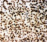 MCM2 Antibody in Immunocytochemistry (ICC/IF)