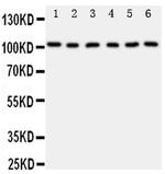 MCM2 Antibody in Western Blot (WB)