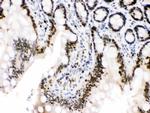 MCM3 Antibody in Immunohistochemistry (Paraffin) (IHC (P))