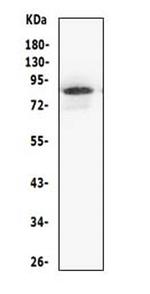 MCM5 Antibody in Western Blot (WB)