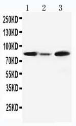 MCM5 Antibody in Western Blot (WB)