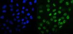 MCM6 Antibody in Immunocytochemistry (ICC/IF)