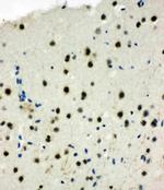 MCM6 Antibody in Immunohistochemistry (Paraffin) (IHC (P))