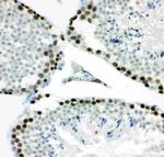 MCM7 Antibody in Immunohistochemistry (Paraffin) (IHC (P))