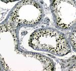 MDC1 Antibody in Immunohistochemistry (Paraffin) (IHC (P))