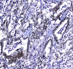 MDC1 Antibody in Immunohistochemistry (Paraffin) (IHC (P))