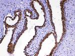 MED4 Antibody in Immunohistochemistry (Paraffin) (IHC (P))