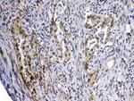 MED4 Antibody in Immunohistochemistry (Paraffin) (IHC (P))