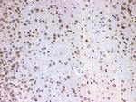 MED4 Antibody in Immunohistochemistry (Paraffin) (IHC (P))