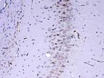 MED4 Antibody in Immunohistochemistry (Paraffin) (IHC (P))