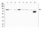 MFN2 Antibody in Western Blot (WB)