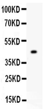 MFN2 Antibody in Western Blot (WB)