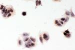 MGMT Antibody in Immunocytochemistry (ICC/IF)