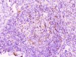 MMP11 Antibody in Immunohistochemistry (Paraffin) (IHC (P))