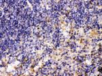 MMP11 Antibody in Immunohistochemistry (Paraffin) (IHC (P))