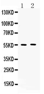 MMP11 Antibody in Western Blot (WB)