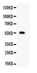 MMP12 Antibody in Western Blot (WB)