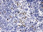 MMP9 Antibody in Immunohistochemistry (Paraffin) (IHC (P))