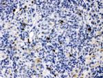 MMP9 Antibody in Immunohistochemistry (Paraffin) (IHC (P))