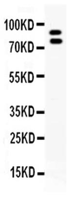 MMP9 Antibody in Western Blot (WB)