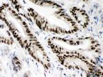 MSH2 Antibody in Immunohistochemistry (Paraffin) (IHC (P))