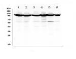 MSH2 Antibody in Western Blot (WB)