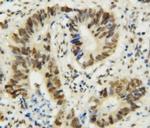 MTA1 Antibody in Immunohistochemistry (Paraffin) (IHC (P))