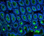 MUC2 Antibody in Immunohistochemistry (Paraffin) (IHC (P))