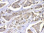 MUT Antibody in Immunohistochemistry (Paraffin) (IHC (P))