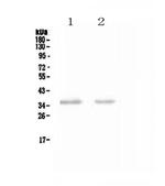 NKp46 (CD335) Antibody in Western Blot (WB)