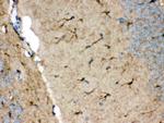 NDRG2 Antibody in Immunohistochemistry (Paraffin) (IHC (P))