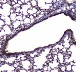 NFIB Antibody in Immunohistochemistry (Paraffin) (IHC (P))