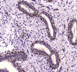 NFIB Antibody in Immunohistochemistry (Paraffin) (IHC (P))