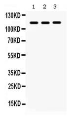 NLRC4 Antibody in Western Blot (WB)