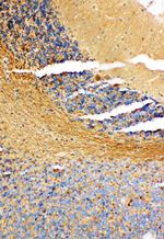 NME1 Antibody in Immunohistochemistry (Paraffin) (IHC (P))