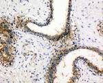 NME1 Antibody in Immunohistochemistry (Paraffin) (IHC (P))