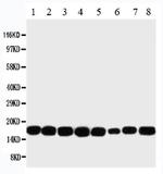 NME1 Antibody in Western Blot (WB)