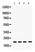 NME1 Antibody in Western Blot (WB)