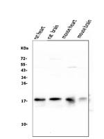 NME2 Antibody in Western Blot (WB)