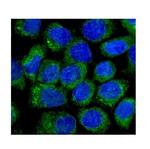 NOV Antibody in Immunocytochemistry (ICC/IF)