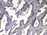 NOV Antibody in Immunohistochemistry (Paraffin) (IHC (P))