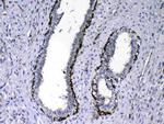 NOV Antibody in Immunohistochemistry (Paraffin) (IHC (P))