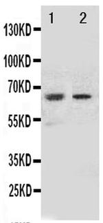 NOX1 Antibody in Western Blot (WB)