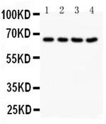 NOX1 Antibody in Western Blot (WB)