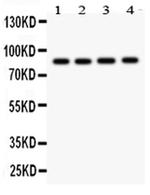 NOX5 Antibody in Western Blot (WB)